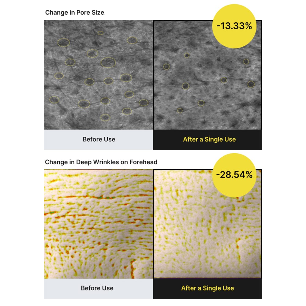 Celimax Retinal Shot before and after